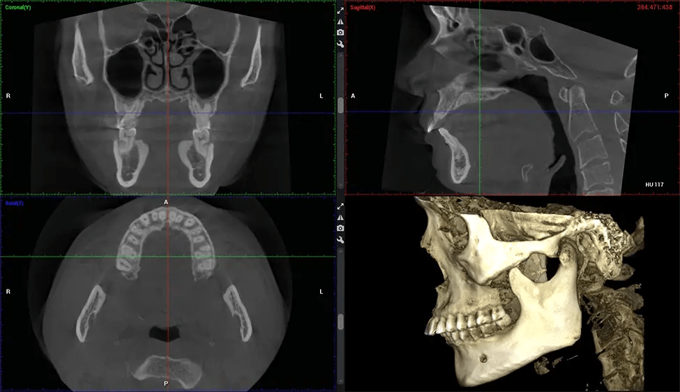 Estudio de ortodoncia Planmeca CBCT G7 de baja radiación