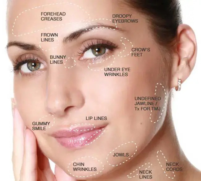 Botox Miami, botox near me, dysport cost miami, botox cost, medspa near me, botox cost miami, cheapest botox miami, cheapest dysport miami